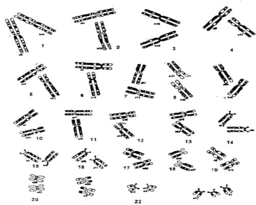 chromosomes